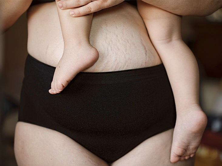 best-postpartum-underwear